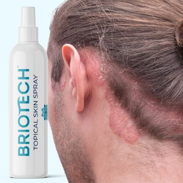 BRIOTECH Topical Skin Spray, Hypochlorous Acid Spray for Body & Face, Eyelid Cleanser, HOCl Facial Mist, Support Against Irritation and Redness, Stocking Stuffers, Packaging May Vary, 4 oz, 1 ct - Image 8